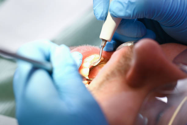 Best Mobile Emergency Dentist in Moss Beach, CA